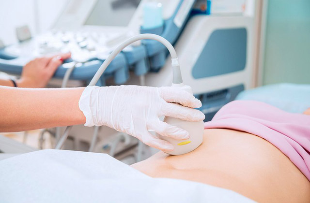 Siêu âm ổ bụng là một cách chẩn đoán buồng trứng đa nang