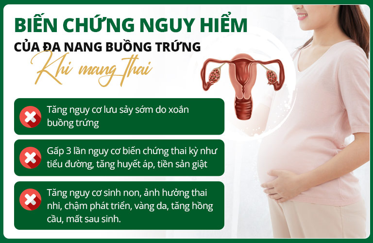 Có thể mang thai tự nhiên nhưng người bị đa nang buồng trứng có thể gặp nhiều rủi ro
