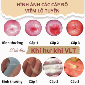 Dấu hiệu nhận biết VLT