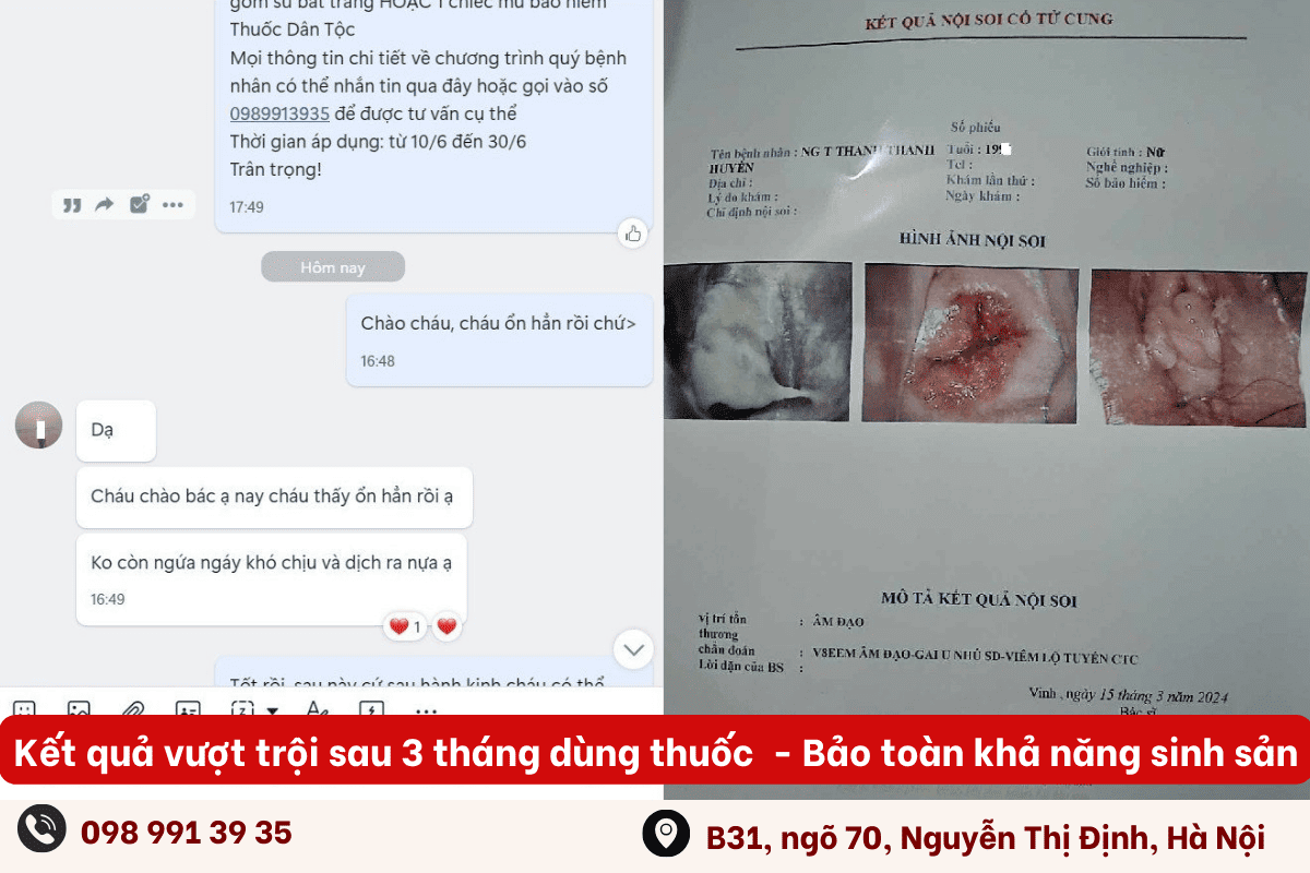 Kết quả vượt trội sau 3 tháng dùng thuốc viêm lộ tuyến