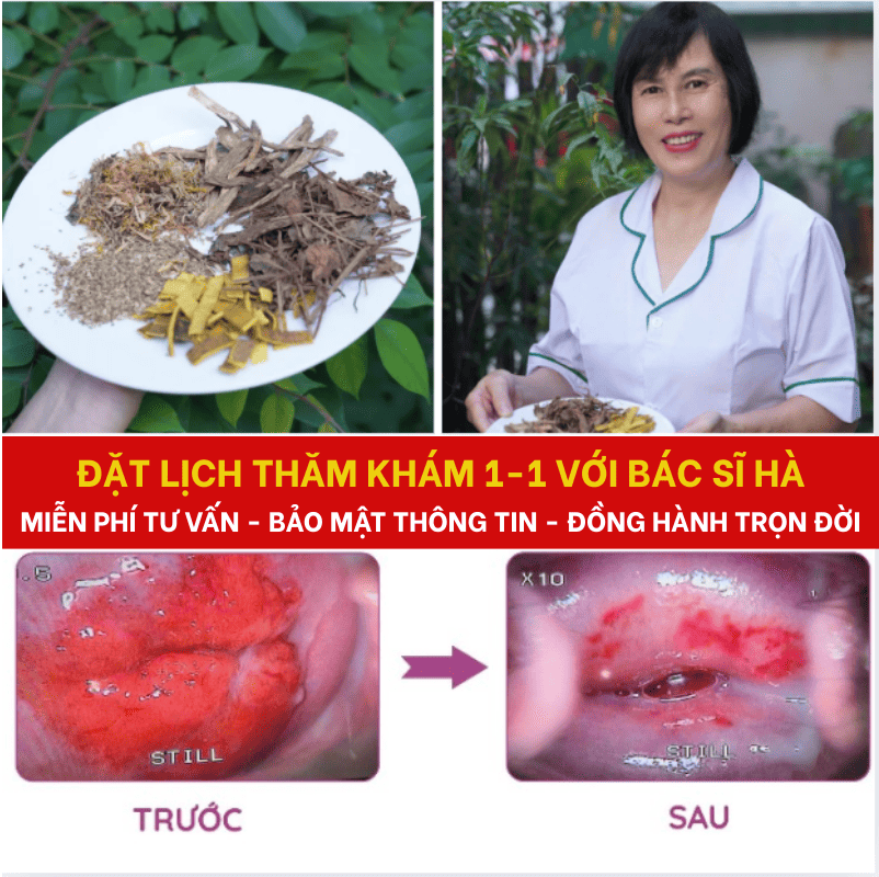 Nguyên tắc xây dựng phác đồ điều trị viêm lộ tuyến