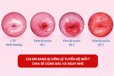 Hiểu đúng về “mức độ” viêm lộ tuyến