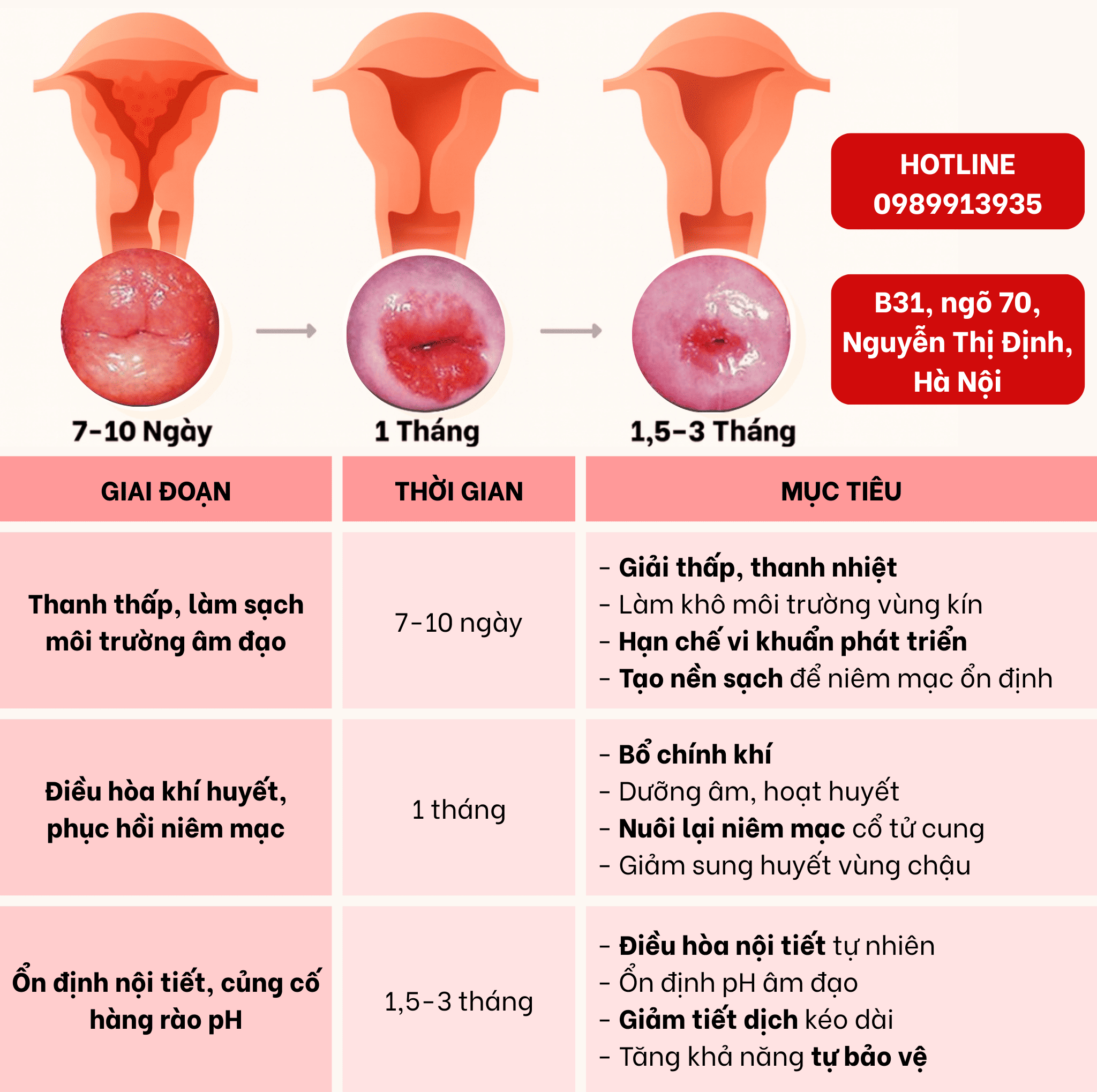 lộ trình xử lý viêm lộ tuyến