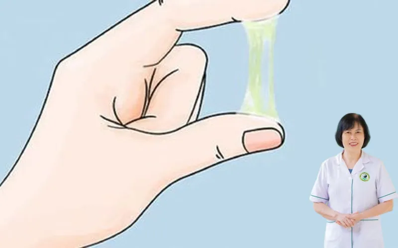 Bệnh huyết trắng c&oacute; g&acirc;y v&ocirc; sinh