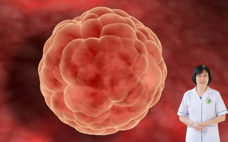 K&iacute;ch thước trứng 17mm c&oacute; thụ thai được kh&ocirc;ng