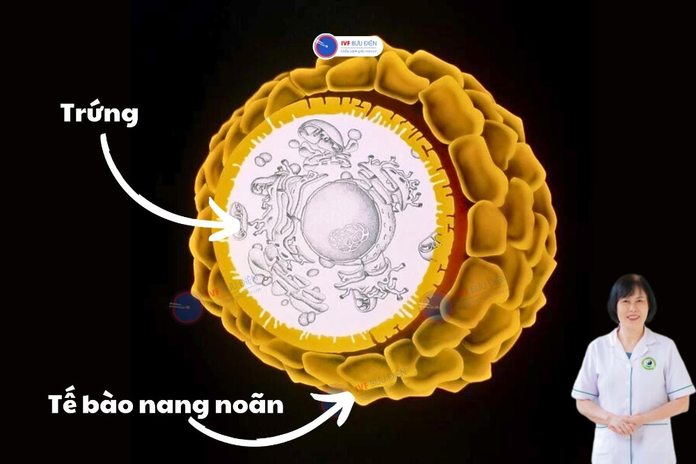 nang xuất huyết buồng trứng