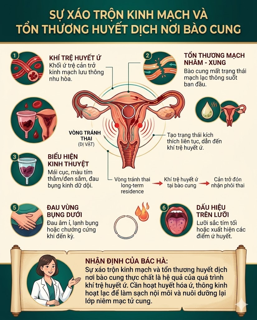 Sự xáo trộn kinh mạch và tổn thương huyết dịch nơi bào cung Sự xáo trộn kinh mạch và tổn thương huyết dịch nơi bào cung